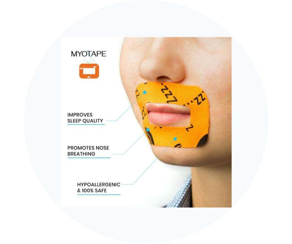Myotape